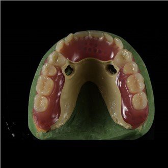 Peek Framework hambaproteesid