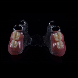 Eemaldatav akrüülist osaline protees