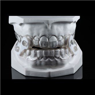 Norskamise kontrolli seadmed