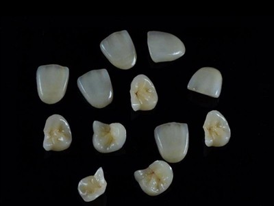 Kuidas valida kroonide jaoks parimat hambaliimi: uusim juhend