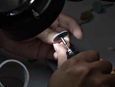 Kui kaua PFM-i kroonid kestavad? Keskmine eluiga, tegurid ja hooldusnõuanded