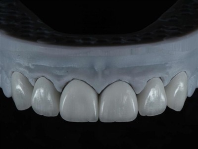 Kuidas tellida hambalabori tehniku ​​tööd välismaalt: põhjalik juhend