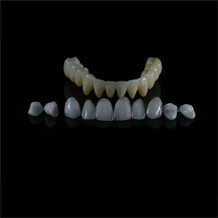Natural Looking and Aesthetic Emax Crown Natural Looking and Aesthetic Emax Crown